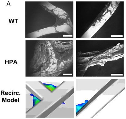 Journal of American College of Cardiology
